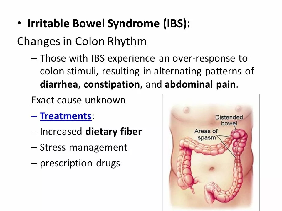 The Connection Between Spironolactone and Irritable Bowel Syndrome